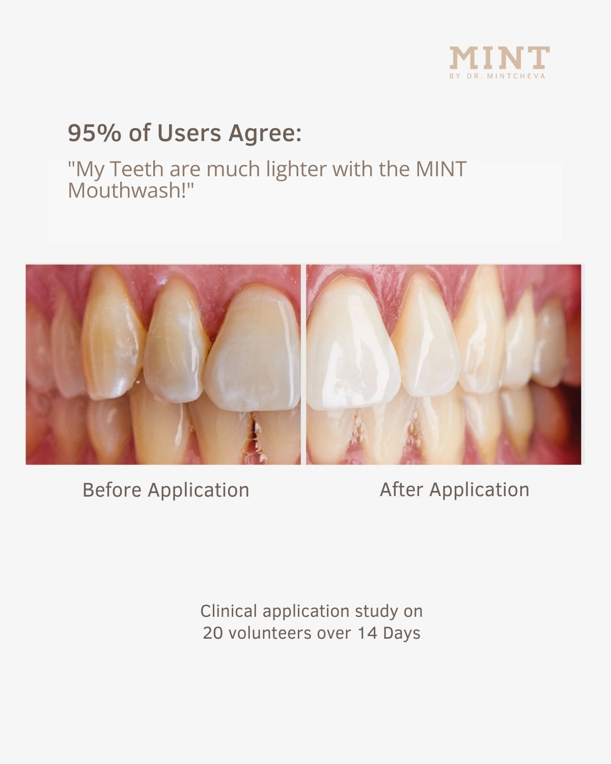 MINT MOUTHWASH WITH HYDROGEN PEROXIDE