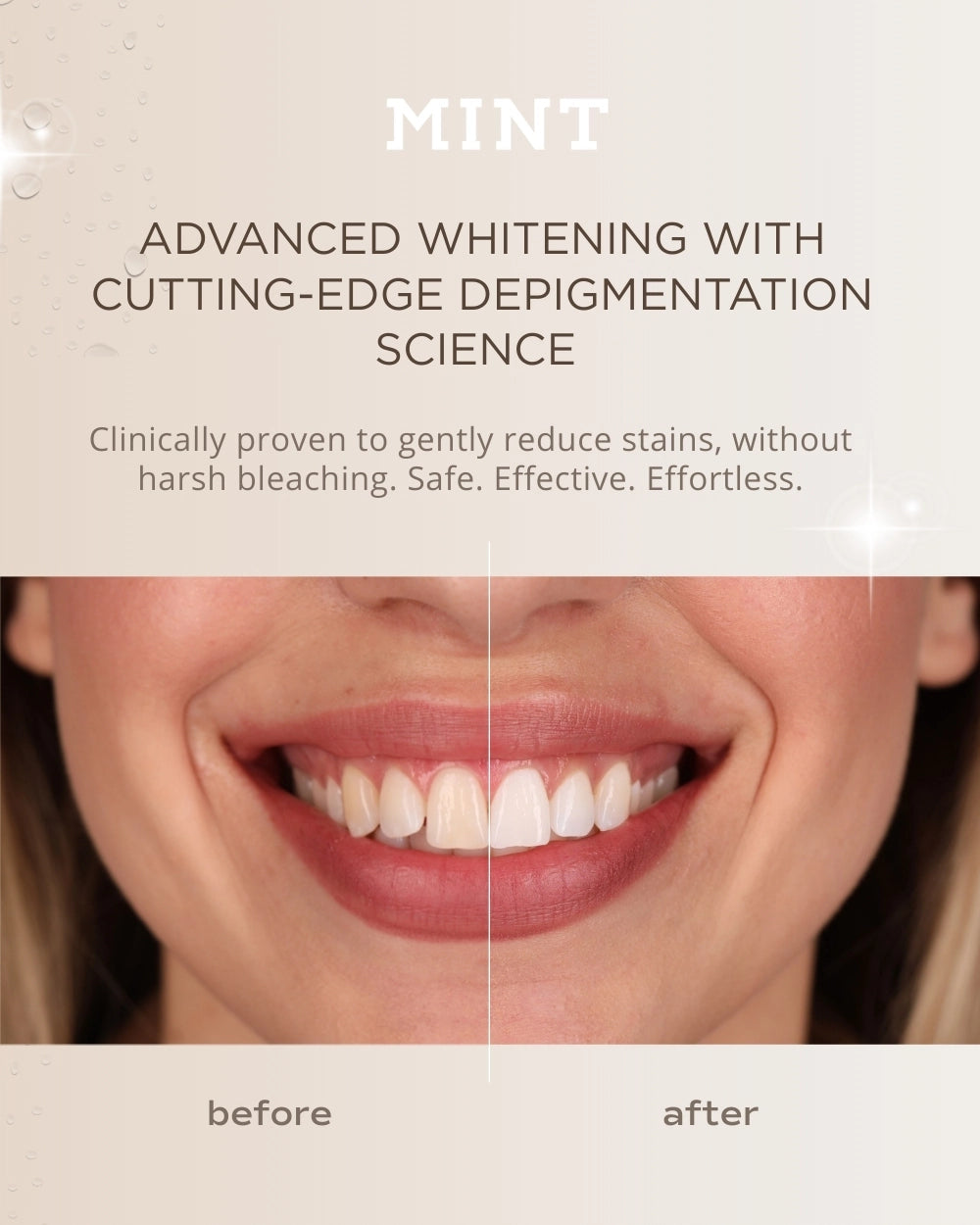 MINT Hollywood Smile Whitening Strips – 14-Day Treatment