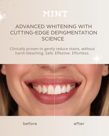 MINT Hollywood Smile Whitening Strips – 14-Day Treatment