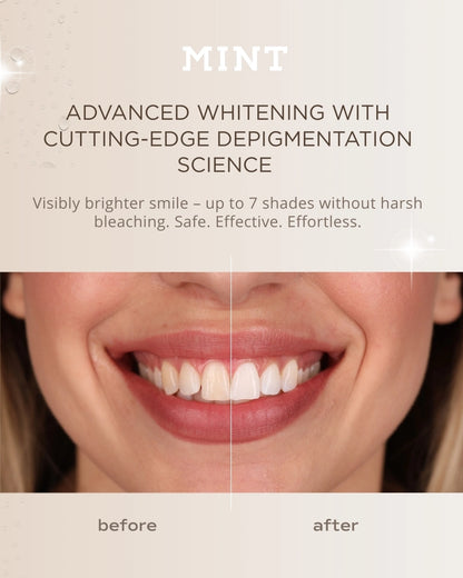 MINT Hollywood Smile Whitening Strips – 7-Day Treatment